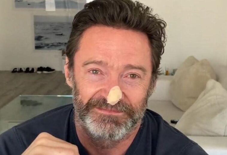 ¡Tenemos que cuidarnos! Hugh Jackman pide a sus fans checarse contra el cáncer de piel