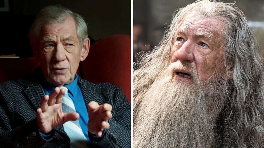 Ian McKellen está hospitalizado tras sufrir un fuerte accidente