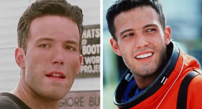 Ben Affleck dientes antes y después