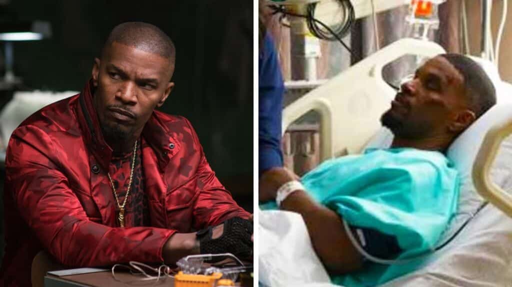 ¿Qué le pasó a Jamie Foxx? El actor reveló los detalles de su accidente